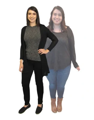 Bariatric patient before and after weight loss
